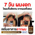 [Mid-Month] Yanhee Teezeer Anti Hair fall Serum [ของแท้] เซรั่มบำรุงผม ยันฮี ทีเซอร์ เซรั่มบำรุงหนังศรีษะ เซรั่มผม ยันฮีผมร่วง บำรุงผมเสีย ผมดกหนา (60ml/ขวด) ส่งฟรี GlowWell. 