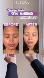 DNA SALMON GEL ESSENCE BY NEW ELEORA