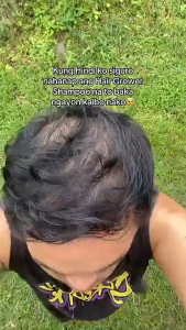 Minoxidil 5% Hair Grower with Biotin Shampoo And Conditioner 300ml for Hair Loss Treatment Hair Growth Shampoo Set