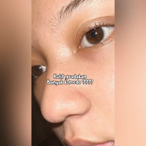 Cyskin Serum untuk Eksfoliasi Kulit Wajah 20 ml I Honey Glow AHA Exfoliating Serum