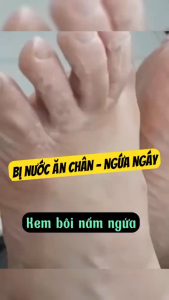 Set 3 Kem Bôi Nấm Ngứa Tay Chân Nhật Bản Tamchink Powder In Gel Giảm Ngứa Khử Mùi Nhanh Chóng Hiệu Quả Và An Toàn