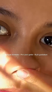 ERTOS FACIAL TREATMENT ORIGINAL ERTOS Facial Treatment Pencuci Muka Face Wash Glowing Penghilang Komedo