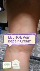 EELHOE | Eelhoe Varicose Vein Repair Cream Smooth Skin Texture Sootheing Leg Fatigue Deep Nourishing Moisturizing Natural Leg Care Cream
