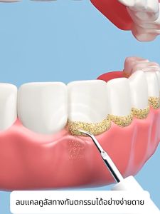 【รับประกัน 5 ปี】Panasonic ที่ขูดหินปูน ไม่ทําร้ายเหงือกและฟัน 5โหมดดูแลฟันอย่างดี IPX7 กันน้ำสองชั้น สั่นสะเทือนความถี่สูง 31000 ครั้ง/นาที ขจัดหินปูนฟันเองได้ง่ายๆ เครื่องขูดหินปูน เครื่องขัดฟัน