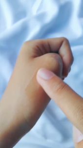 Viva Acne Gel Triple Action