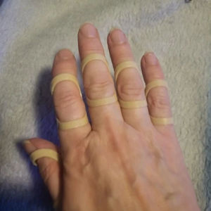 Adjustable 5PCS Finger Splint Bracket Protector Straightening Arthritis Finger Splint Fixed Broken Finger Joint Stabilizer