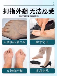 [100000 People Have Been Cured] Hallux Valgus Patch Toe Overlapping Anti-Wear Big Foot Bone Valgus Correction Special Plaster