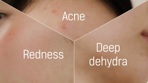 COSRX Low pH Good Morning Gel Cleanser BHA 0.5%Daily Mild Cleanser for Sensitive Skin