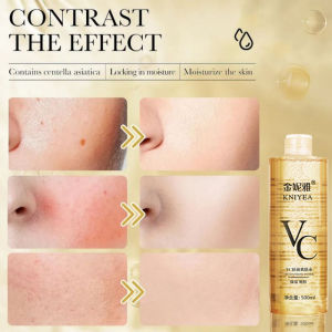 ✨VC Toner 500ml - Mencerahkan & menghidratkan Toner wajah dengan Vitamin C | Toner VC 500ml - Mencerahkan & Melembap Kulit Sesuai untuk Semua Jenis Kulit (Semua Jenis Kulit)