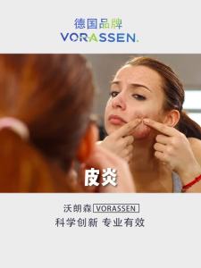 💗🙋♀️💗沃朗森汗状疱疹软膏消毒灭菌止痒皮肤湿疹顽固皮炎手上起小水泡