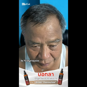 The Oriental Essence ชุดเซรั่มและสเปรย์เพิ่มผมหนา รักษาผมบางและผมร่วง แพคคู่ 100ml