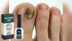 Hyaluronic Acid Nail Hardener Nourish Brittle Hands Feet Nails Repair Dry Breakage Nails Gloss Growth Nail Strengthening Drops