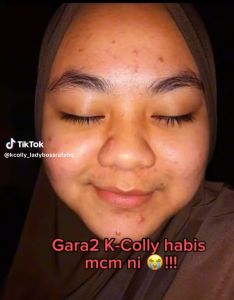 K COLLY NANO ADVANCE 20 SACHET ORIGINAL HQ