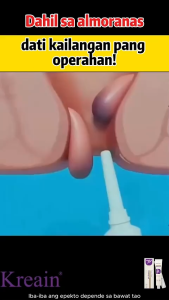 Kreain Nature Hemorrhoid gel relieves hemorrhoid pain and helps eliminate hemorrhoids