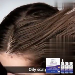 EELHOE Hair Growth Essence 60ml * 3pcs Preventing Hair Loss Liquid Anti Hair Loss Damage Hair Repair