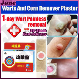 🎈𝒔𝒈 𝒔𝒕𝒐𝒄𝒌🎈 Corn plaster removal / Corn patch / Corn removal foot corn remover / Chicken eye removal / 雞眼貼 雞眼去除 雞眼膏 鸡眼贴