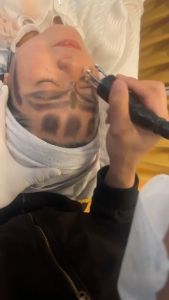 Bọ Cạp Hoa Khế Bạc 5 Chân Bi Bạc - Đánh Gió Giải Cảm - Dụng Cụ Diện Chẩn