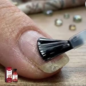 Fungal Nail Treatment Serum Toe Infection Removal Anti Gray Nails Restores Damaged Discolored Nail Treating Paronychia Liquid