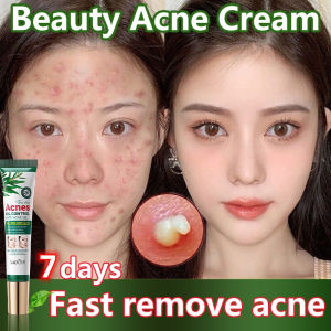 Acne Gel Tea Tree Serum oil control soothing moisturizing mild skin care original herbal ubat jerawat dan parut 20g