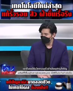 ⚡️ส่งไวส่งฟรี⚡️Y8 คู่นี้คุ้มเซรั่ม สบู่ล้างฝ้ากระ ช่วยผืวกระจ่างใสไร้ฝ้ากระ เหมาะผิวอ่อนแอแพ้ง่าย