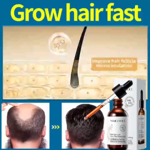Anti-hair loss conditioner rapid hair growth essence anti-hair loss 60ml nourishes hair roots natural hair growth essential oil promotes hair regeneration gentle hair care