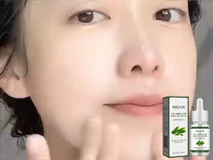 Điều trị mụn trứng cá Serum khuôn mặt Thiết chất dầu cây trà Làm ẩm co lỗ chân lông Mụn trứng cá Serum khuôn mặt