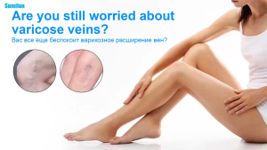 Effective varicose vein ointment tendon unblocking ointment original varicose vein cream Effective treatment for vasculitis Quick treatment of varicose veins in the legs