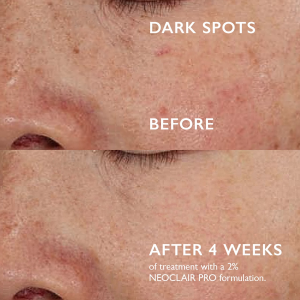 [FOR: Radiant Skin] QLABO Brightology Glow-Boosting Antioxidant Serum 35ml 🟠Brightens Complexion Lighten Pigmentation Lifts Sagginess Reduces Wrinkles Evens Uneven Skin Tone