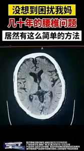 เจลประคบเย็นหลังซู๋อี้ถาง - เทคโนโลยีอินฟราเรด บรรเทาอาการปวดหลังและความตึง