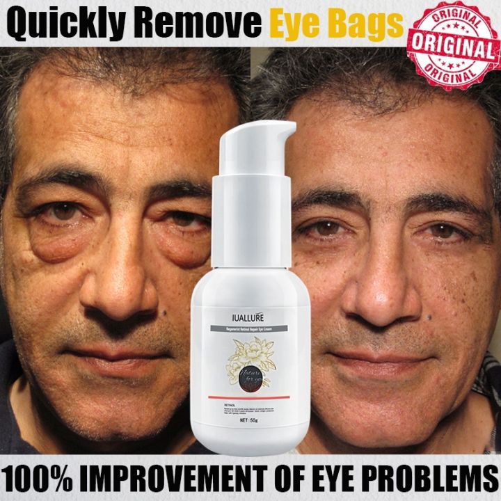 IUALLURE Eye Essence OilEye Cream for Dark Circles eye bag remover eye care Anti Aging Remove Fine Lines Fat Particles  Fade Dark Circles Fine Lines Lift Anti-Wrinkle  眼霜Firming Remove Eye Bags Men Women