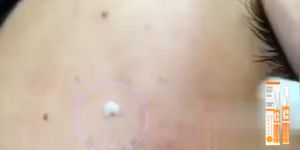 Kem diệt tàn nhang (Loại bỏ tàn nhang nhanh chóng) kem làm trắng da hiệu quả kem ngừa nám Chuyên sâu Loại bỏ các đốm đen Sắc tố làm sáng da Chăm sóc da chống nắng Loại bỏ tàn nhang Loại bỏ Melanin Chăm sóc Da trắng sáng Tự nhiên