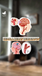 Sumbagold Susu Kuda Liar Untuk Bantu Sembuhkan Sakit Stroke Ringan Atasi Lemah Otot Kesemutan Sakit Kepala Mendadak Hipertensi Asam Urat Bantu Pemulihan Stroke Tanpa Efek Samping