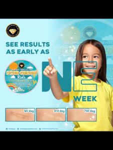 Scar Remover for Kids Safe Gentle Pedia Approved Scar Eraser Cream Anti Peklat Lotion for Children Babies Insect Bites Wounds Scratch