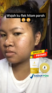 Queensi Body Soap Care With Sulfur - Membantu Mencerahkan, Mengatasi Jerawat & Gatal