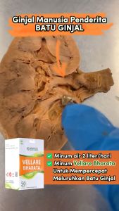 Obat Batu Ginjal Ampuh Obat Kencing Batu & Prostat Obat Batu Empedu VELLARE BHARATA