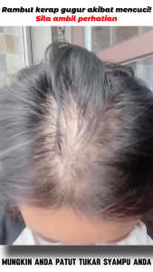 Ginger Shampoo Fast Powerful Hair Growth Liquid 300ml without silicone oil repair dry ranunculus damaged hair loss hair shampoo Promotes Hair