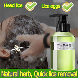 Head lice shampoo Lice removal shampoo for adults kids Quickly remove dandruff Anti lice aliz shampoo for kids Anti Dandruff 100ml Oil Control Anti-Dandruff Repair damage scalp care Pure Organic Kills hair lice larvae and lice eggs vacuum para sa