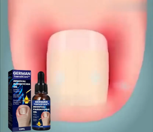 Serum ngăn ngừa nấm móng tay chân phục hồi móng thối móng hư móng