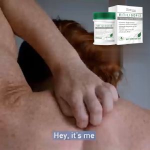 EELHOE 15g White spot repair cream lighten white spots moss versicolor skin repair hand and foot moss external use repair cream