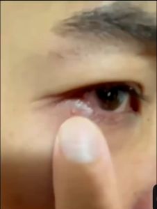 Avocado moisturizing eye cream moisturizes the eyesfades fine lines雅琪诺牛油果保湿眼霜保湿滋润眼部淡化细纹黑眼圈眼袋脂肪粒眼部