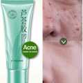 Aloe Vera Gel Pelembab Gel lidah buaya perawatan wajah. 