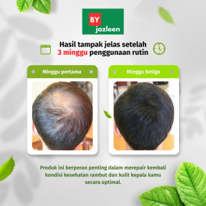 Shampo Penumbuh Rambut Cepat Anti Rambut Rontok Botak Ginger Shampoo 250ml Kontrol Minyak Menyegarkan Pelembab Nutrisi Sampo Minyak Kemiri Original