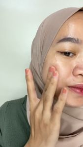 Serum Acne Swana Pore Minimizer Mencerahkan Kulit Dan Pengecil Poripori Penghilang Jerawat Di Wajah