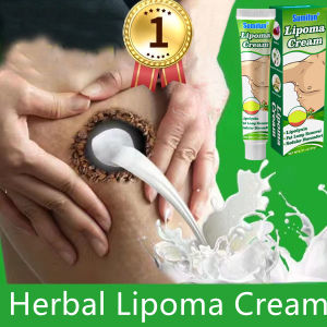Lipoma Removal Cream Multiple anti-tumor cellulite removal cream Lipolysis Fat Lump Relieve Plaster Skin Swelling Ointment 20g