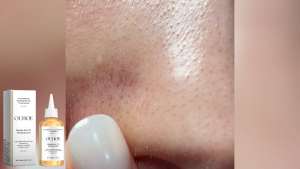 OUHOE Low-concentration glycolic acid hydrating toner that soothes exfoliation without drying refines pores evens out dullness and acne marks perfect for damp application as a serum