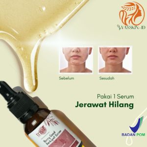 Serum Triva Darkspot: Mengatasi Noda Hitam & Mencerahkan Kulit