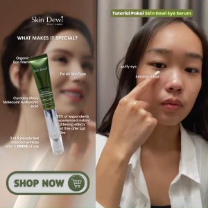 Skin Dewi Lip & Eye Care Set