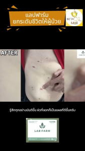 แล็บฟาร์ม Lab farm 1กล่อง10แคปซูล Immuneo Plust™ สารสำคัญเอกสิทธิ์เฉพาะ บริษัท โฮปฟูล จำกัด มี ยีสต์ เบด้า-กลูแคน : Yeast Beta-Glucan 80% (AS Immuneo Plus™) ถึง 200mg