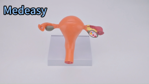 Medical Science Teaching Model Plastic Uterus  Model