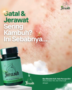 JERASIH OBAT HERBAL JERAWAT & KERUSAKAN KULIT SERTA GATAL ISI 30 KAPSUL 500 mg